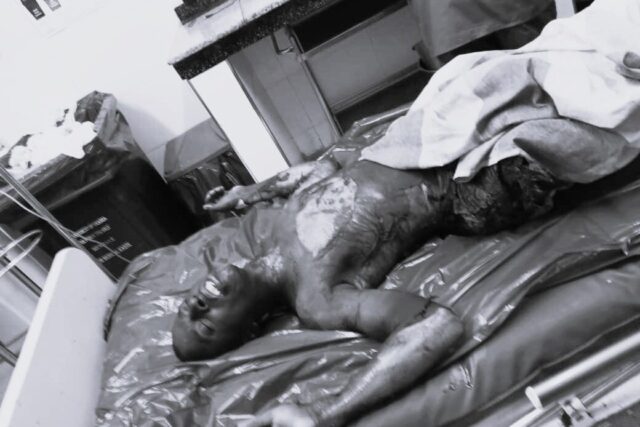 Child Kid burns himself after failing to get aggregate 4 in PLE 2023